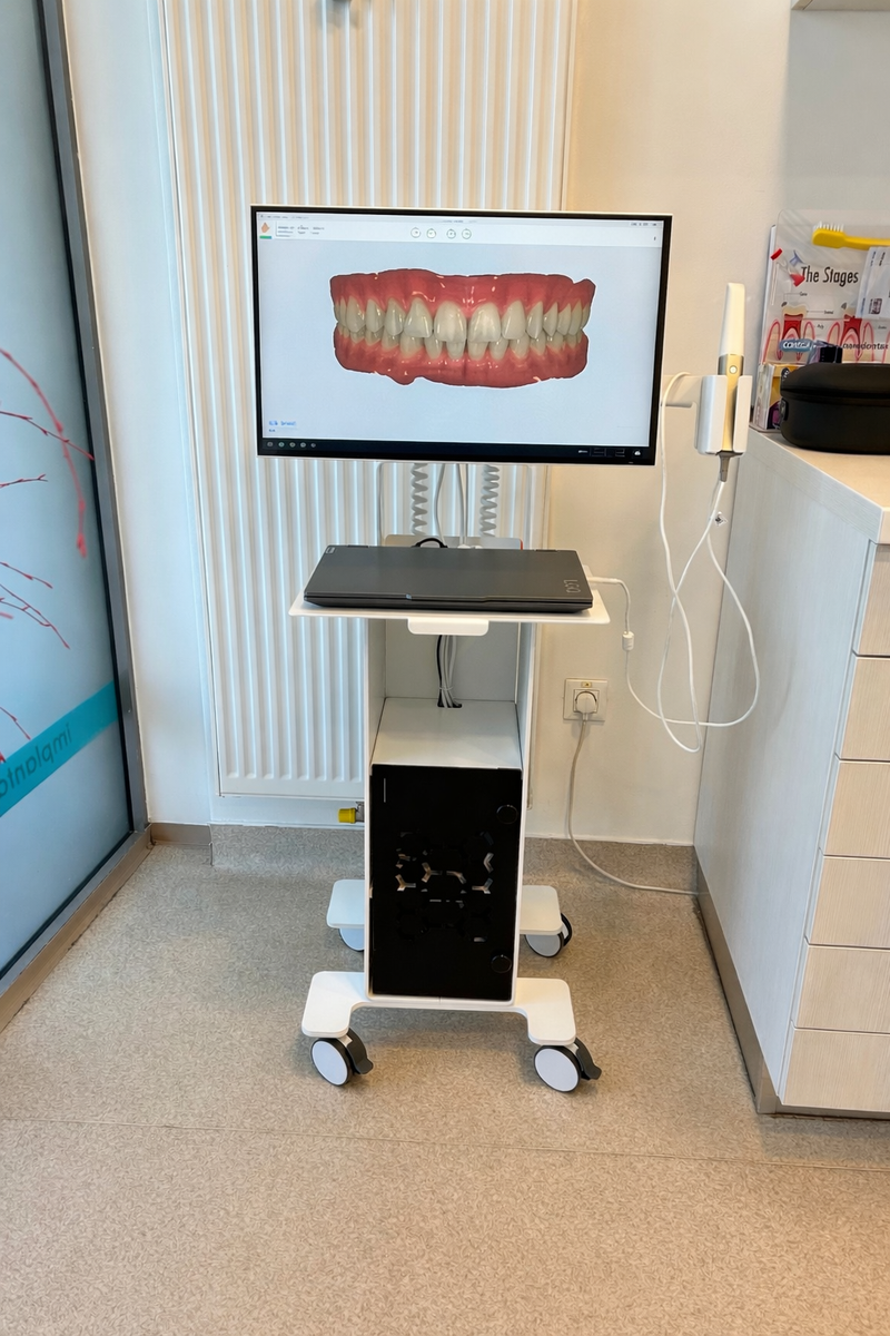 3DDS intraoral scanner cart with Shining 3D Aoralscan Elite scanner, monitor and desktop PC